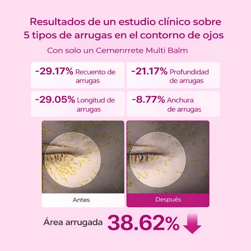 Resultados estudio clinico contorno de ojos
