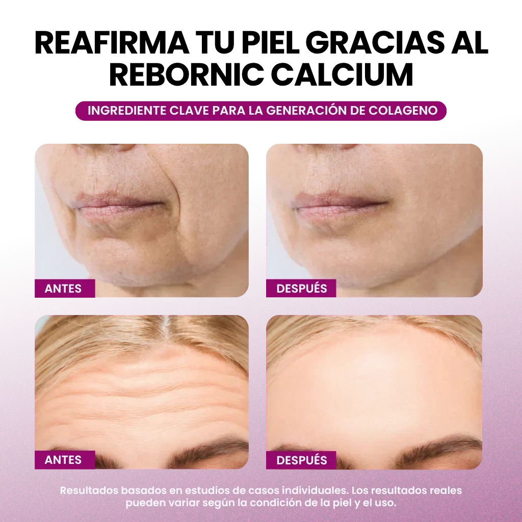 Antes y despues - lineas de expresion