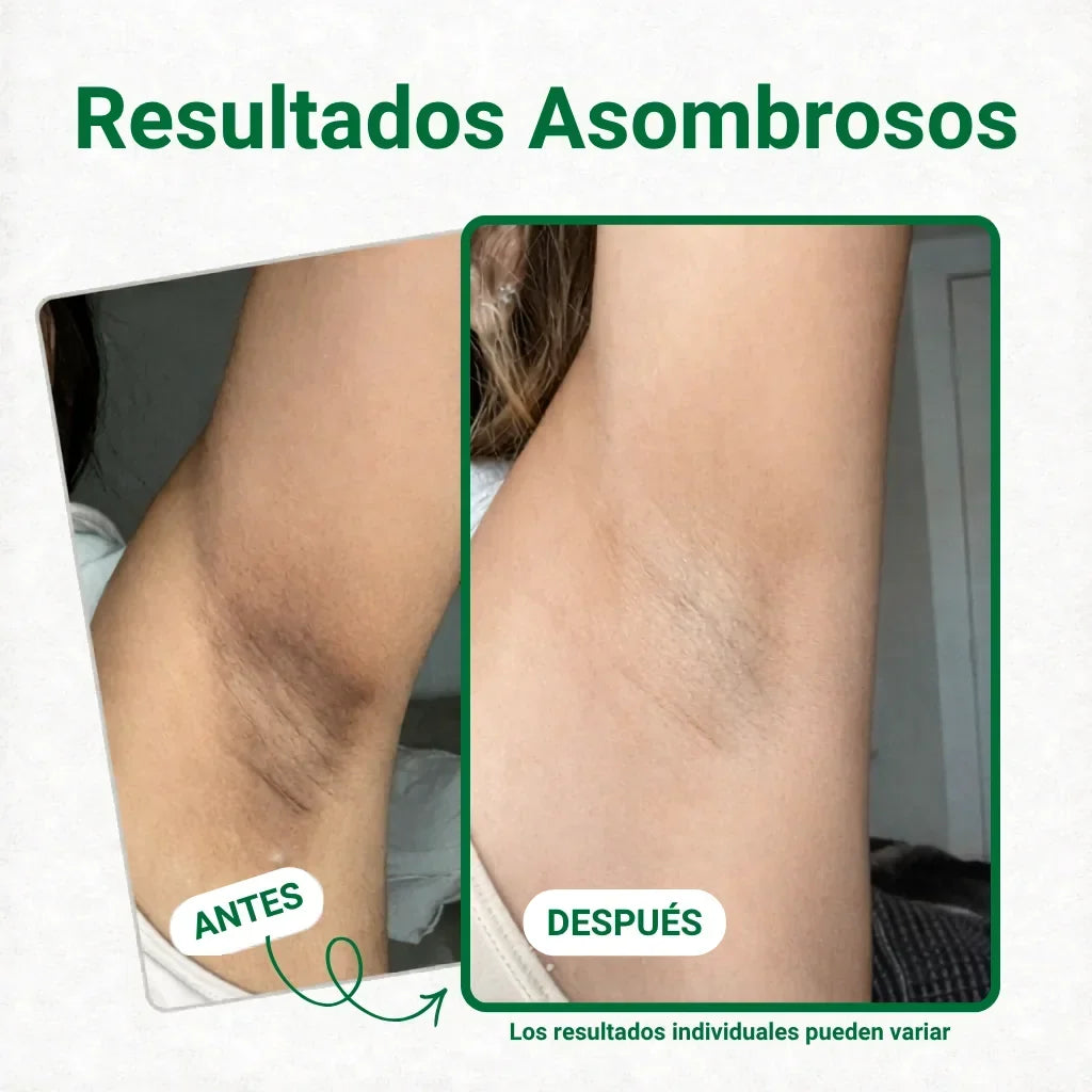 Zonas de uso del producto