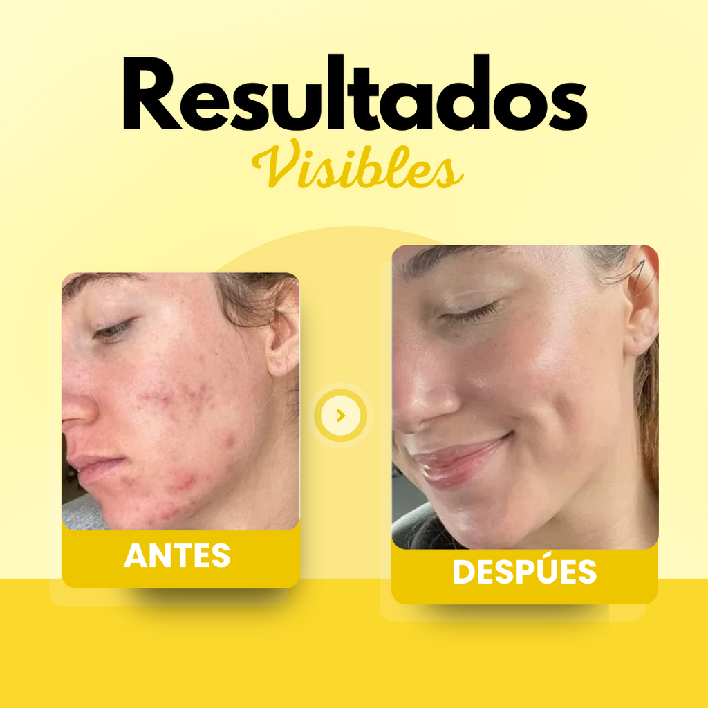 Resultados en la piel